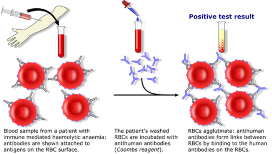 Feeding process image